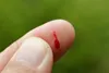 finger bleeding
