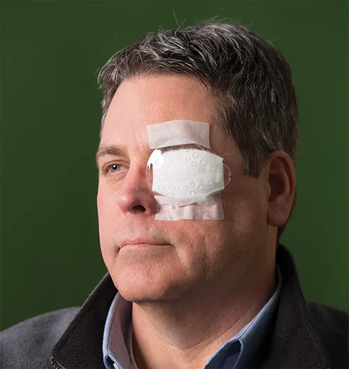 man with eye bandage