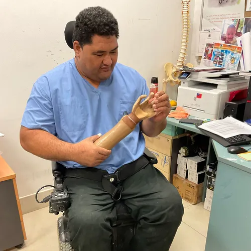 man holding a prosthetic arm